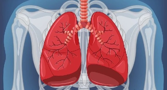 Pneumothorax